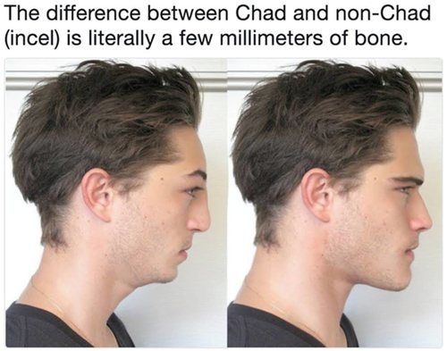 'La diferencia entre un Chad y un no-Chad (incel) es literalmente unos pocos milímetros de hueso'