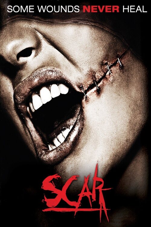 'Scar' (2007).